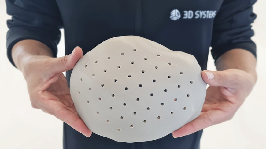 3D SYSTEMS ANNOUNCES FDA CLEARANCE FOR WORLD’S FIRST 3D-PRINTED PEEK CRANIAL IMPLANTS